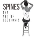 Sydnee Lubar's book Spines: The Art of Scoliosis