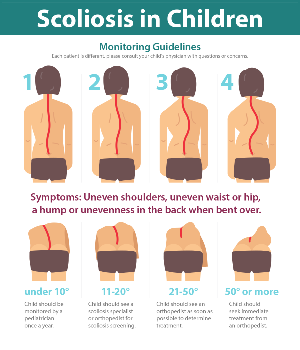 thoracic kyphoscoliosis