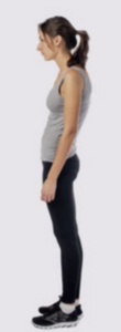 woman with Flatback leading to Swayback Posture