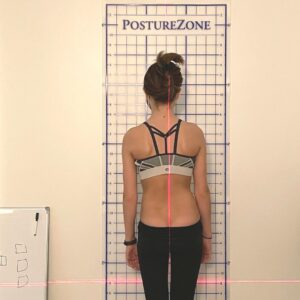 Torso Re-Shaping with Scoliosis-Specific Exercises and Custom