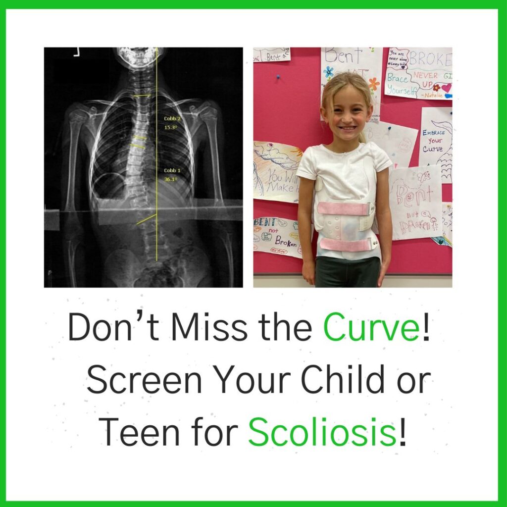 X-ray with scoliosis and girl in brace