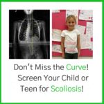 X-ray with scoliosis and girl in brace